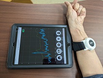 ニューロノードの写真